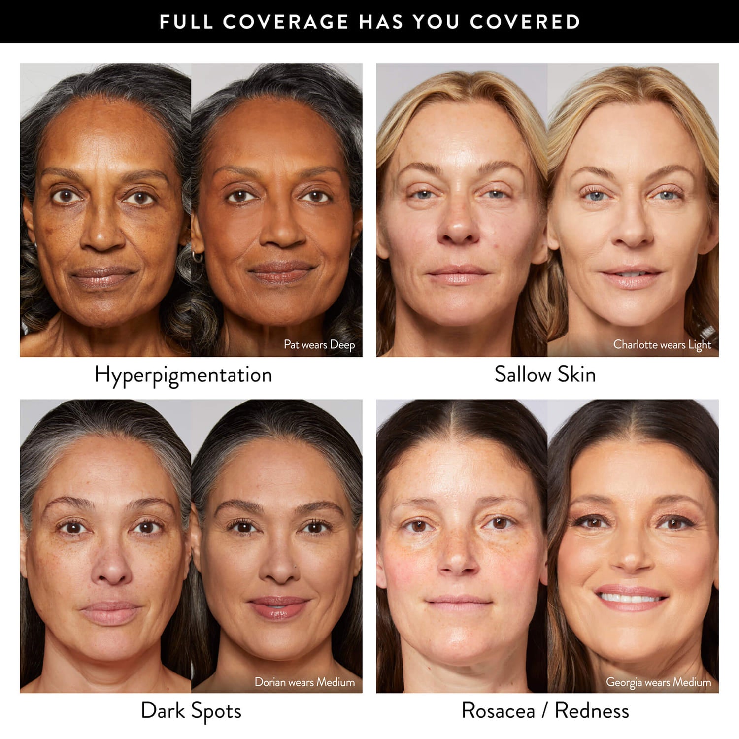 Laurageller Baked Starter Kit - Full Coverage (3PC) - Image 7